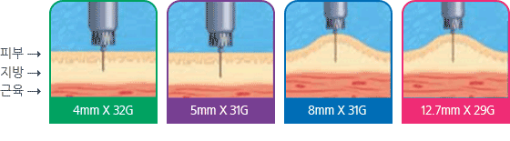피부 - 지방 - 근육 순으로 위치, 4mm X 32G 바늘, 5mm X 31G, 8mm X 31G(피부를 집어올린 후 주사), 12.7mm X 29G(피부를 집어올린 후 주사)