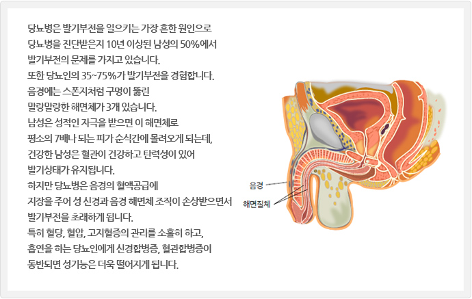 눈과 망막